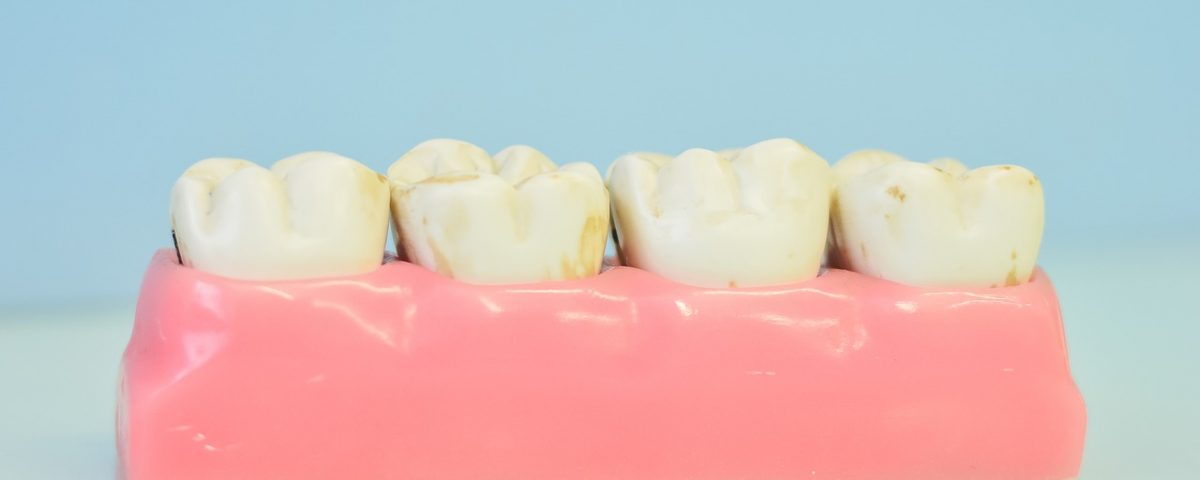 composite pour cabinet dentaire