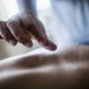 Acupuncture