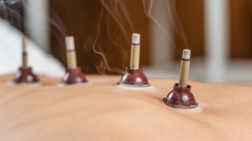 Acupuncture à Antibes
