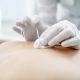 Acupuncture Toulouse