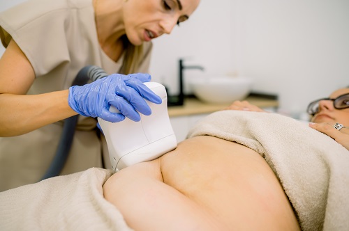 Cryolipolyse