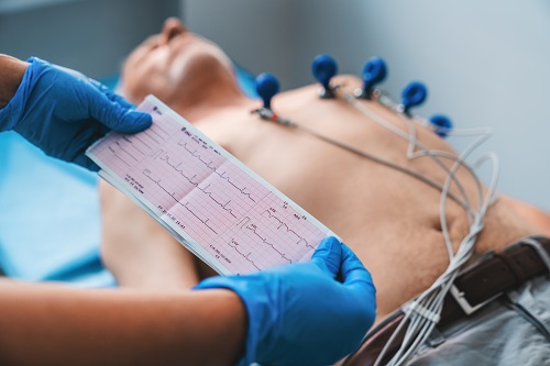 Electrocardiogramme